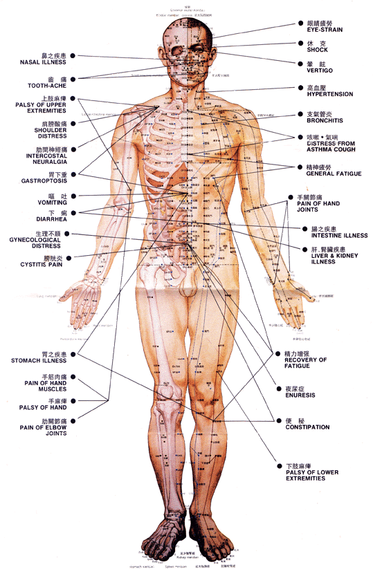 Accupuncture